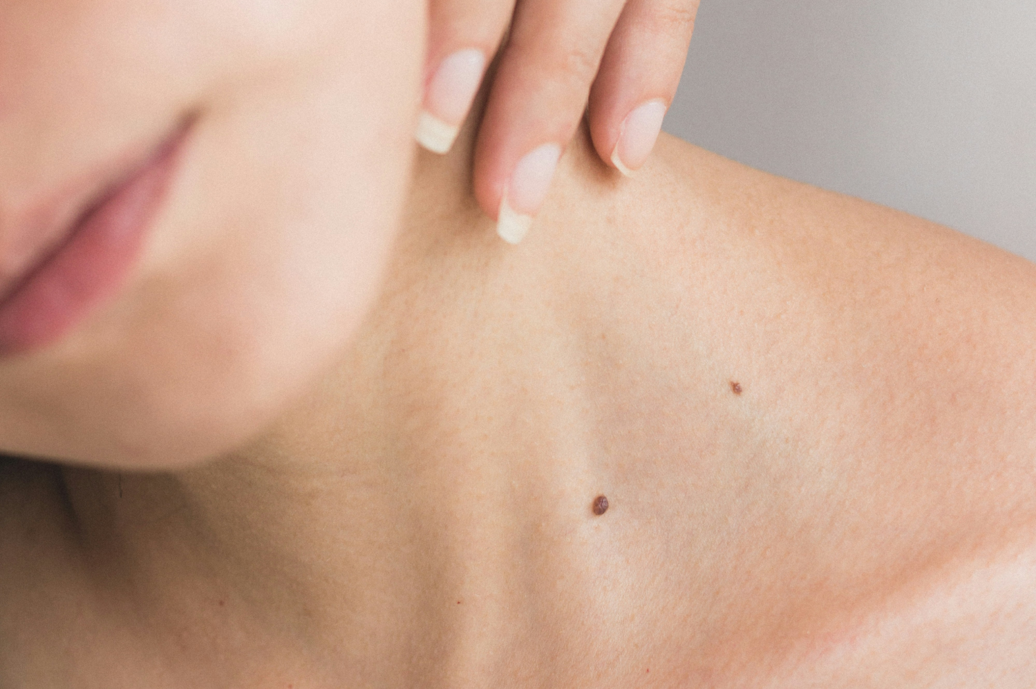 Tipos de câncer de pele: prevenção, sintomas e tratamentos