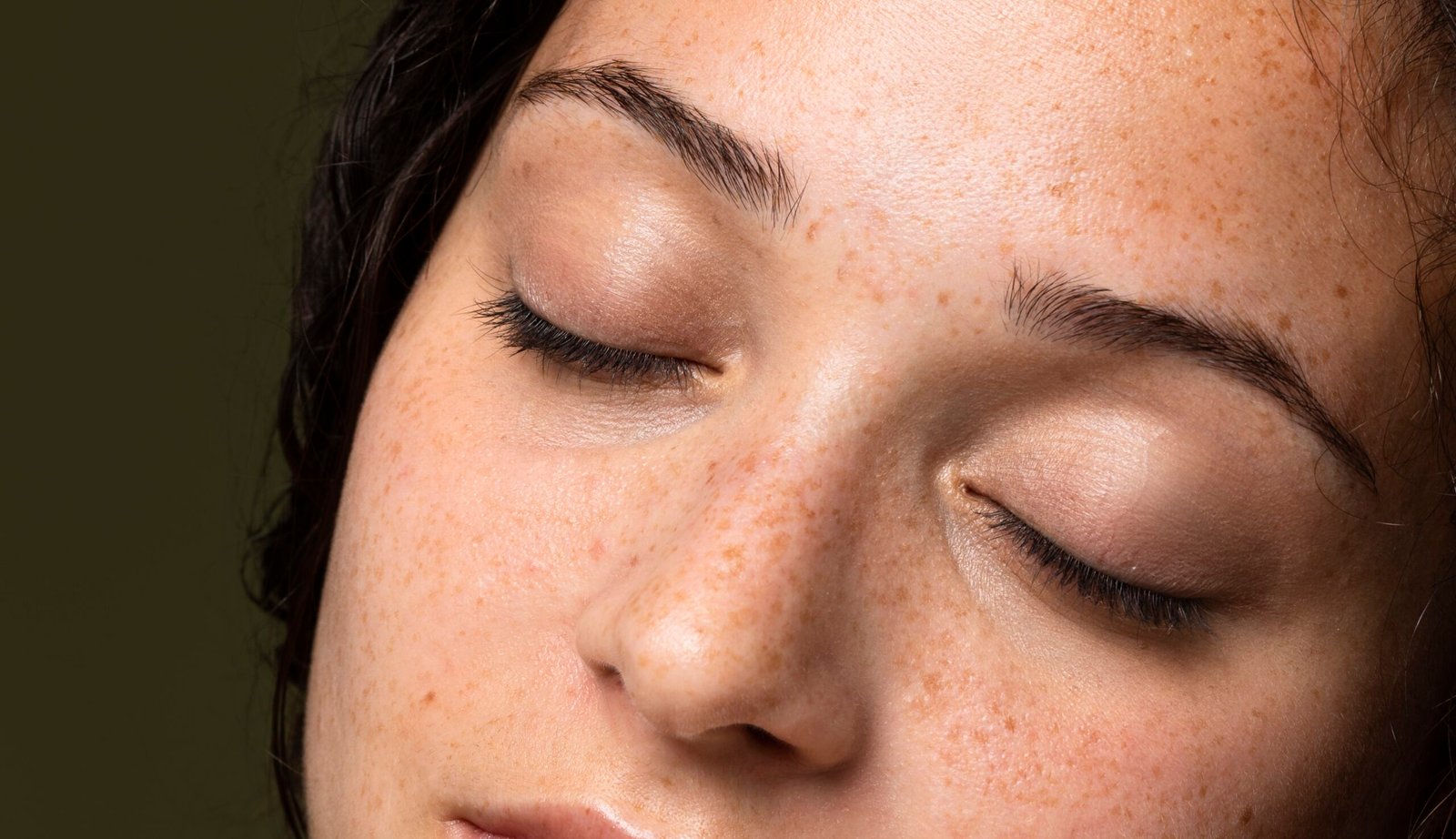 Como tratar o melasma no rosto: estratégias seguras e eficazes