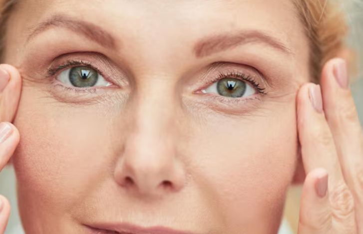 Rugas nos olhos: Guia completo para tratar a flacidez e recuperar o olhar