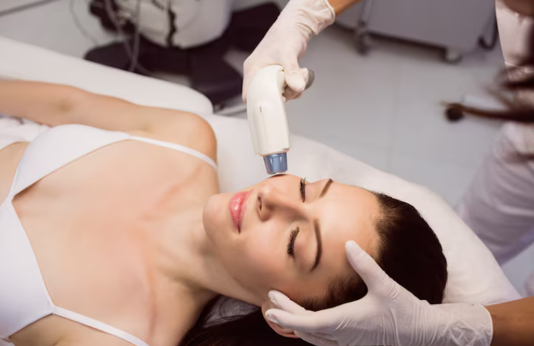 Fotona 4D: Tudo o que você precisa saber sobre o lifting facial sem cortes