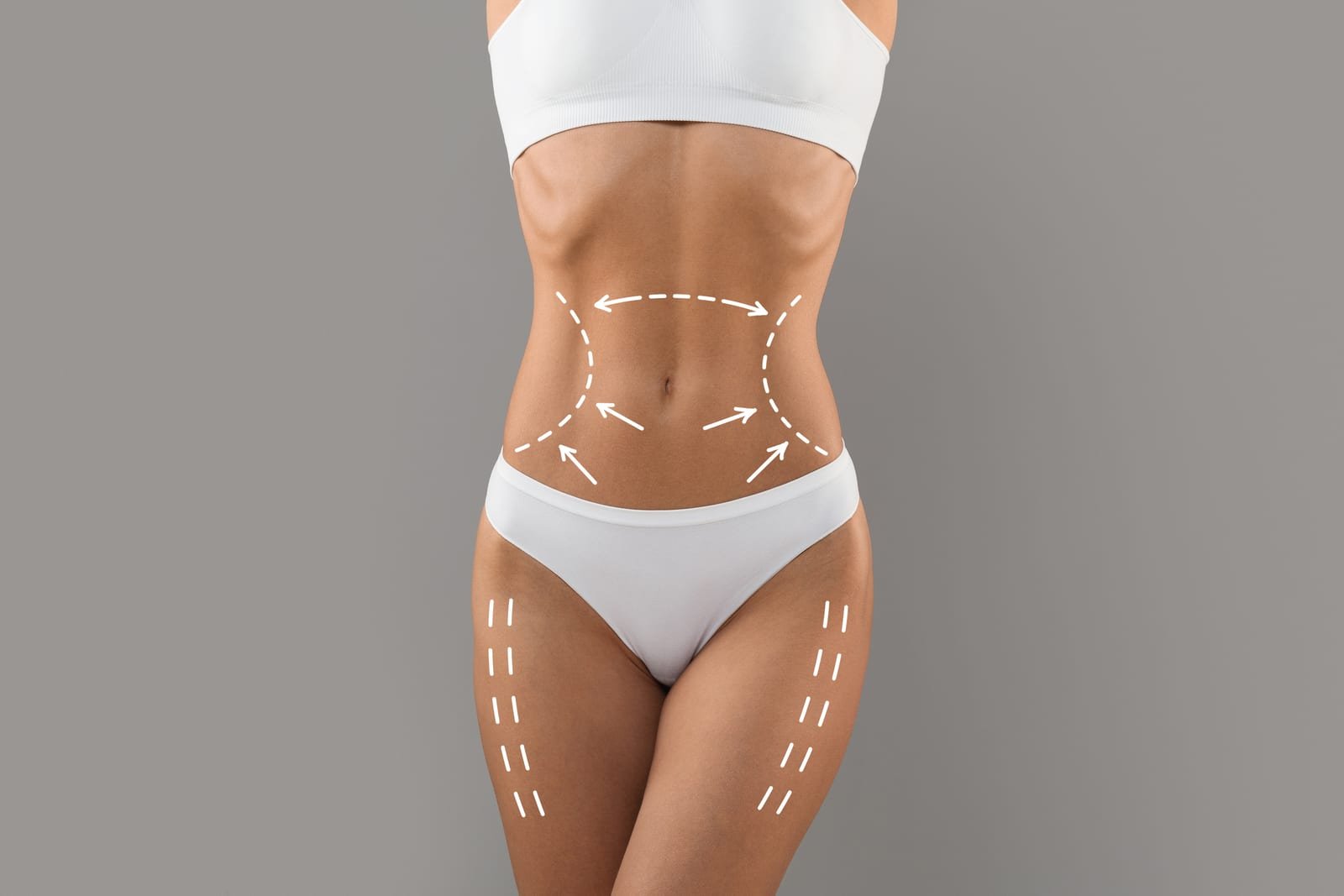 Avaliação para abdominoplastia, cirurgia que remodela o abdome e redefine a cintura