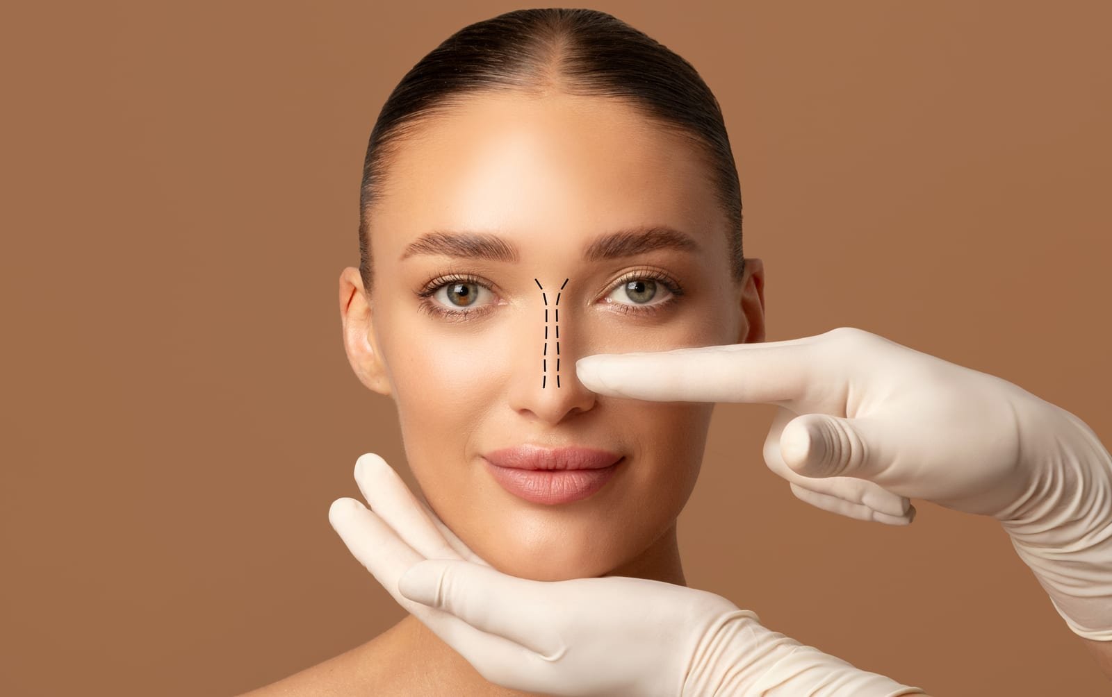 Avaliação para rinoplastia, cirurgia que harmoniza o nariz com o rosto