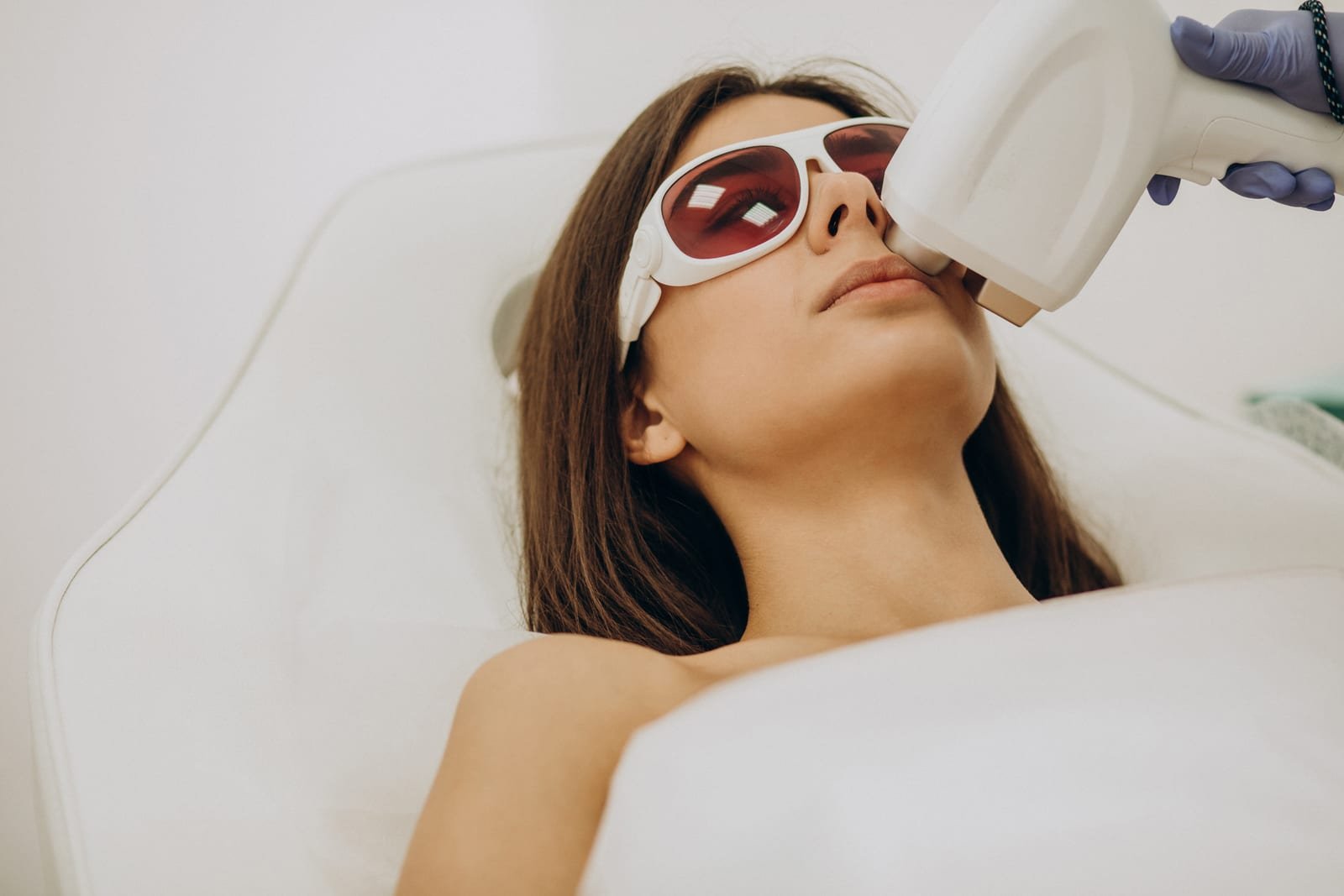 Aplicação de laser fracionado na pele em consultório dermatológico