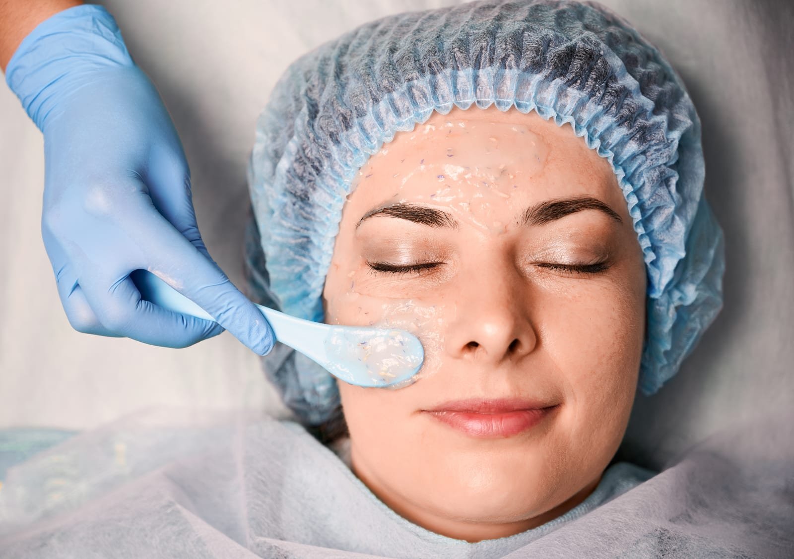 Aplicação de peeling químico em consultório dermatológico