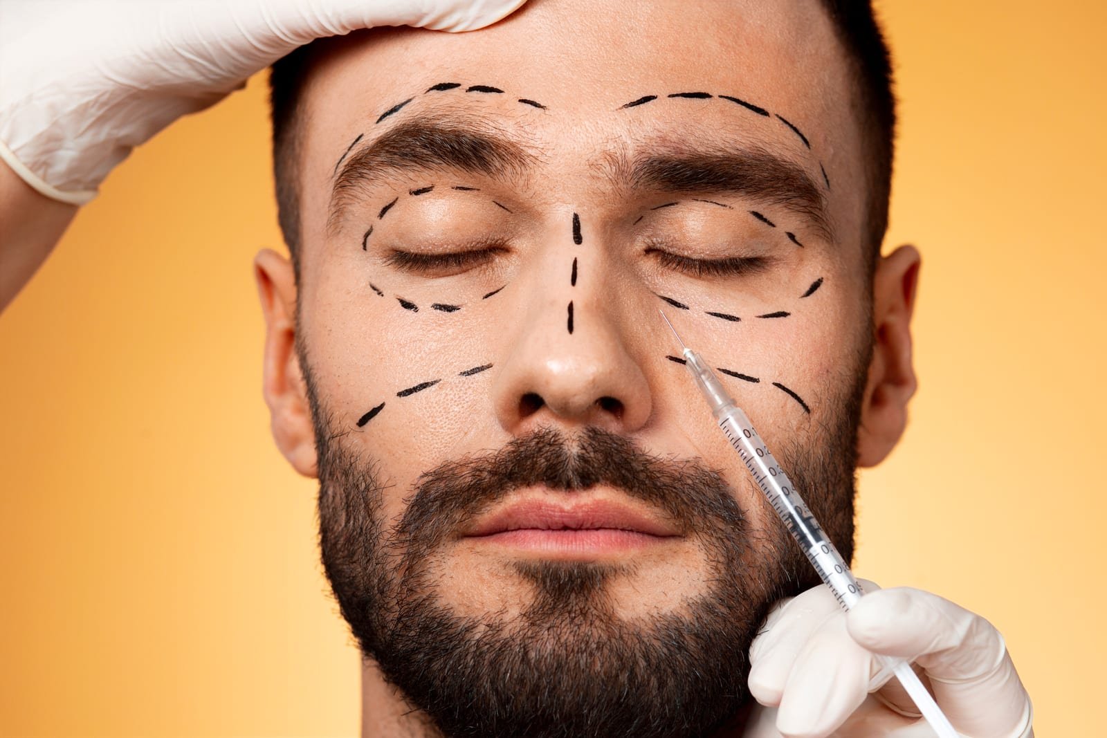 Aplicação de toxina botulínica masculina no consultório dermatológico