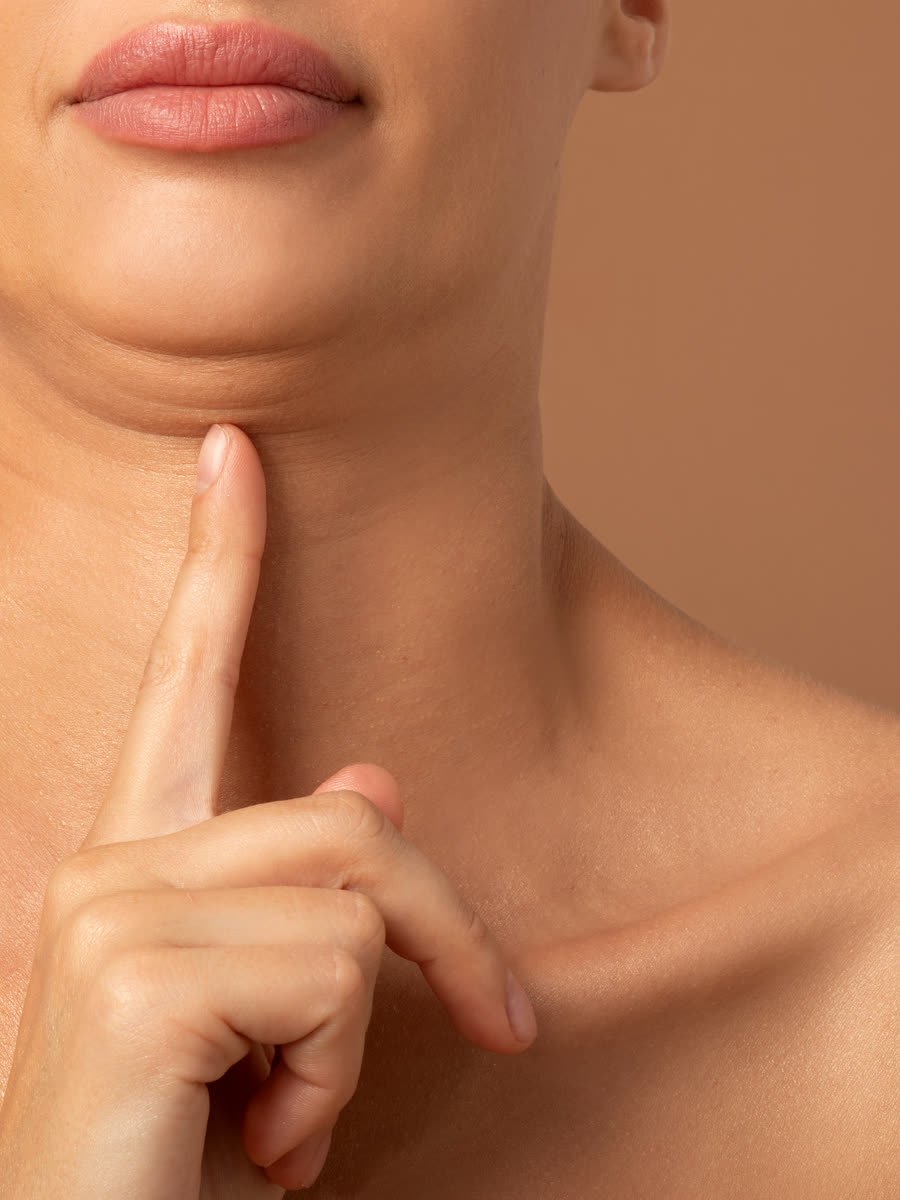 Avaliação da papada para lipo
