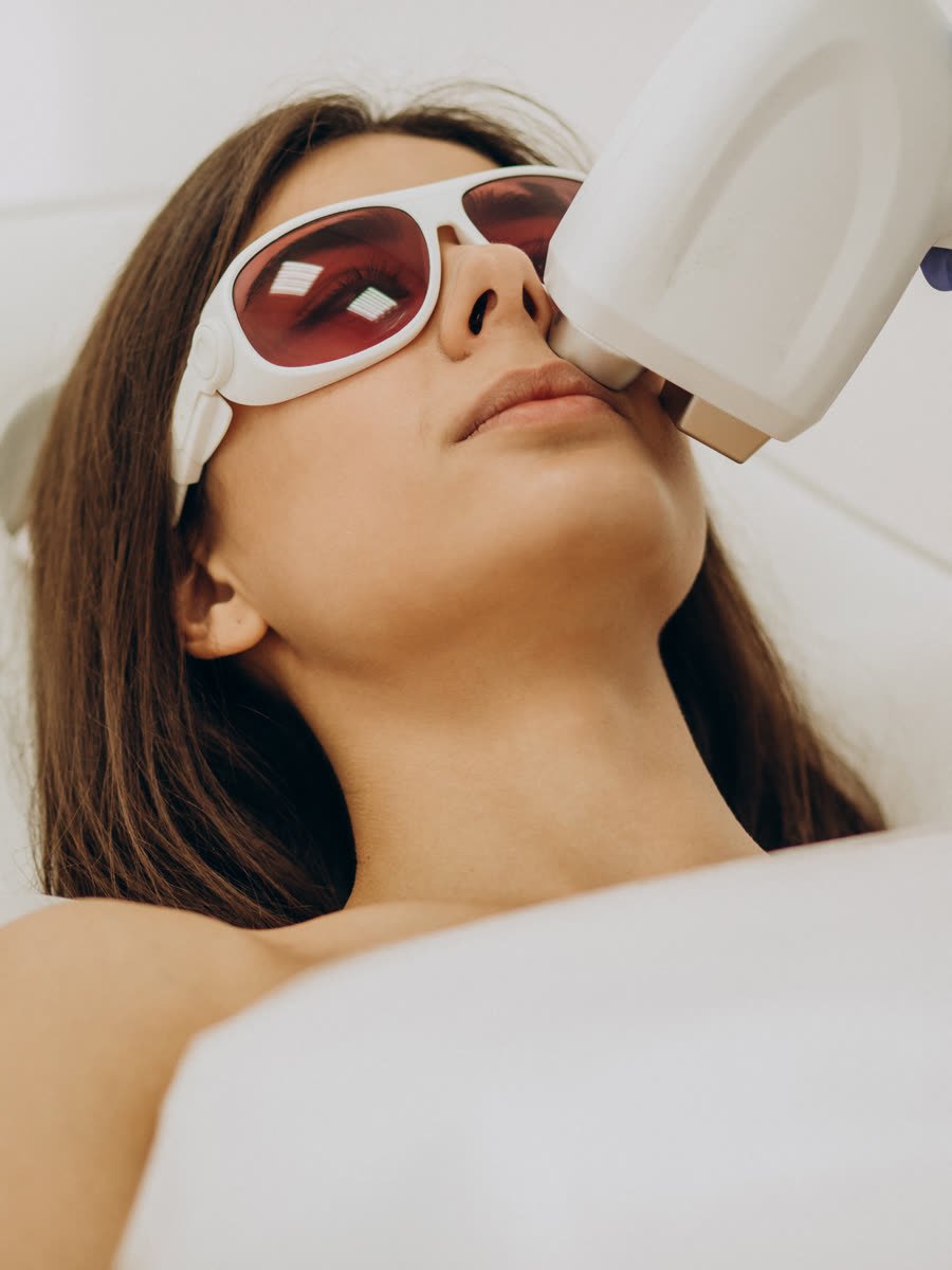 Paciente recebendo aplicação de laser fracionado com proteção ocular