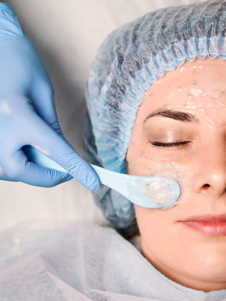 Aplicação de peeling químico no rosto em consultório